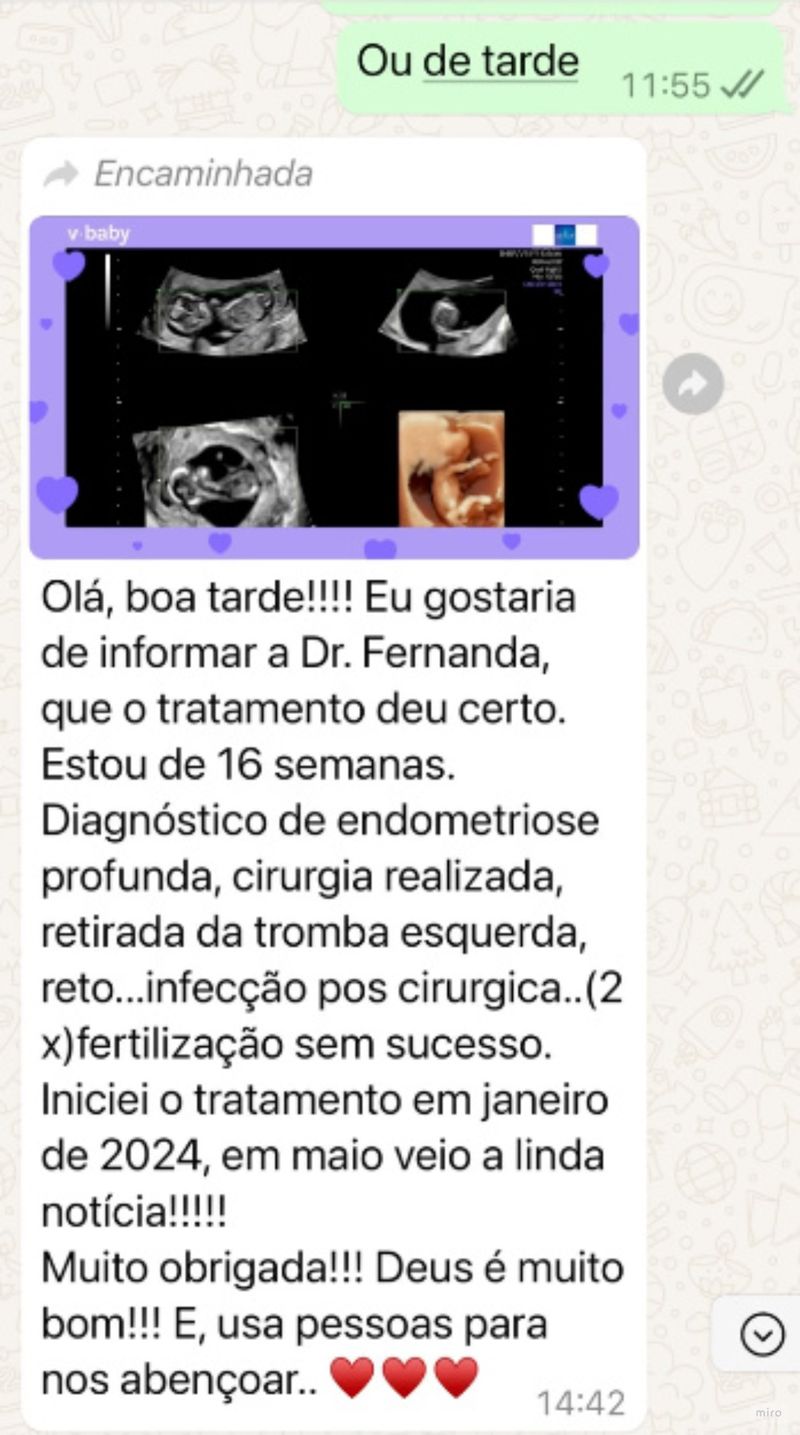 Depoimento – endometriose profunda, gestação após tratamento